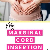 marginal cord insertion experience