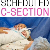 what to expect before a c-section