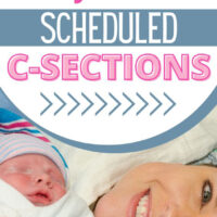 what to expect before a c-section